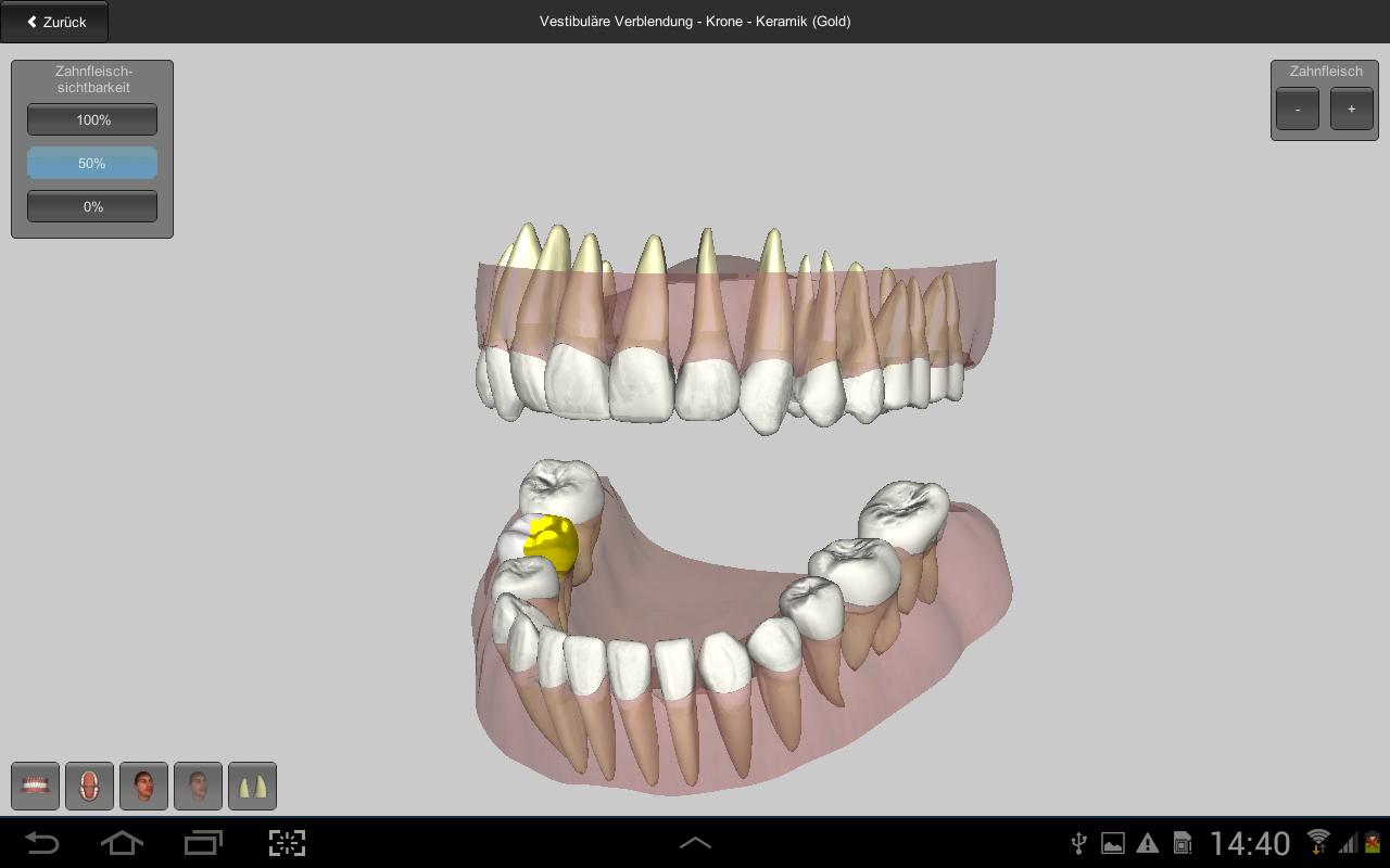 CGM VISODENT 3D App